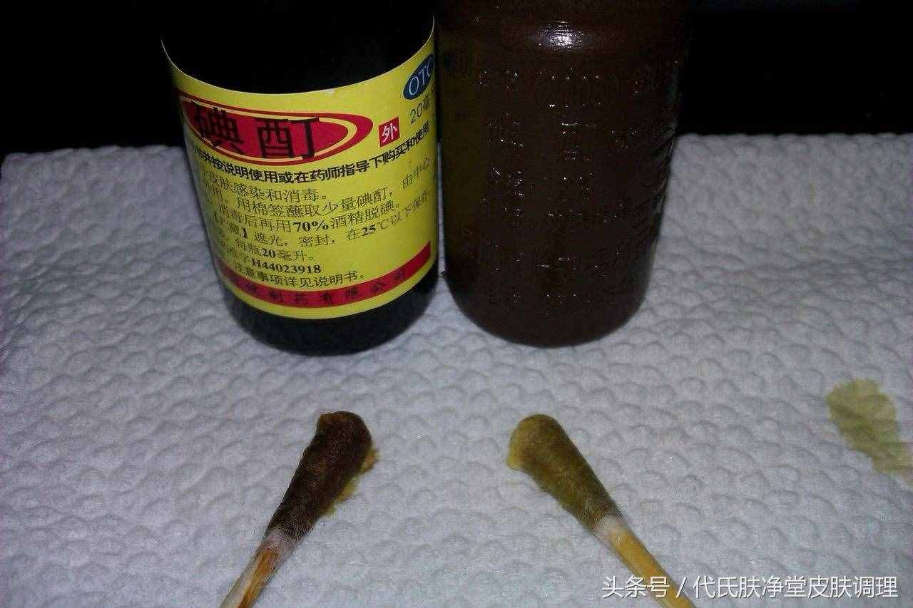 五塊錢的小偏方還您亮白指甲！灰指甲什么的根本不在話下！