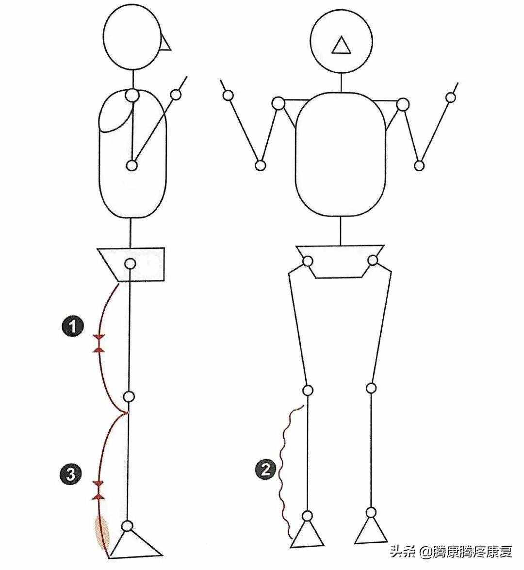 跟腱炎的分析與診療