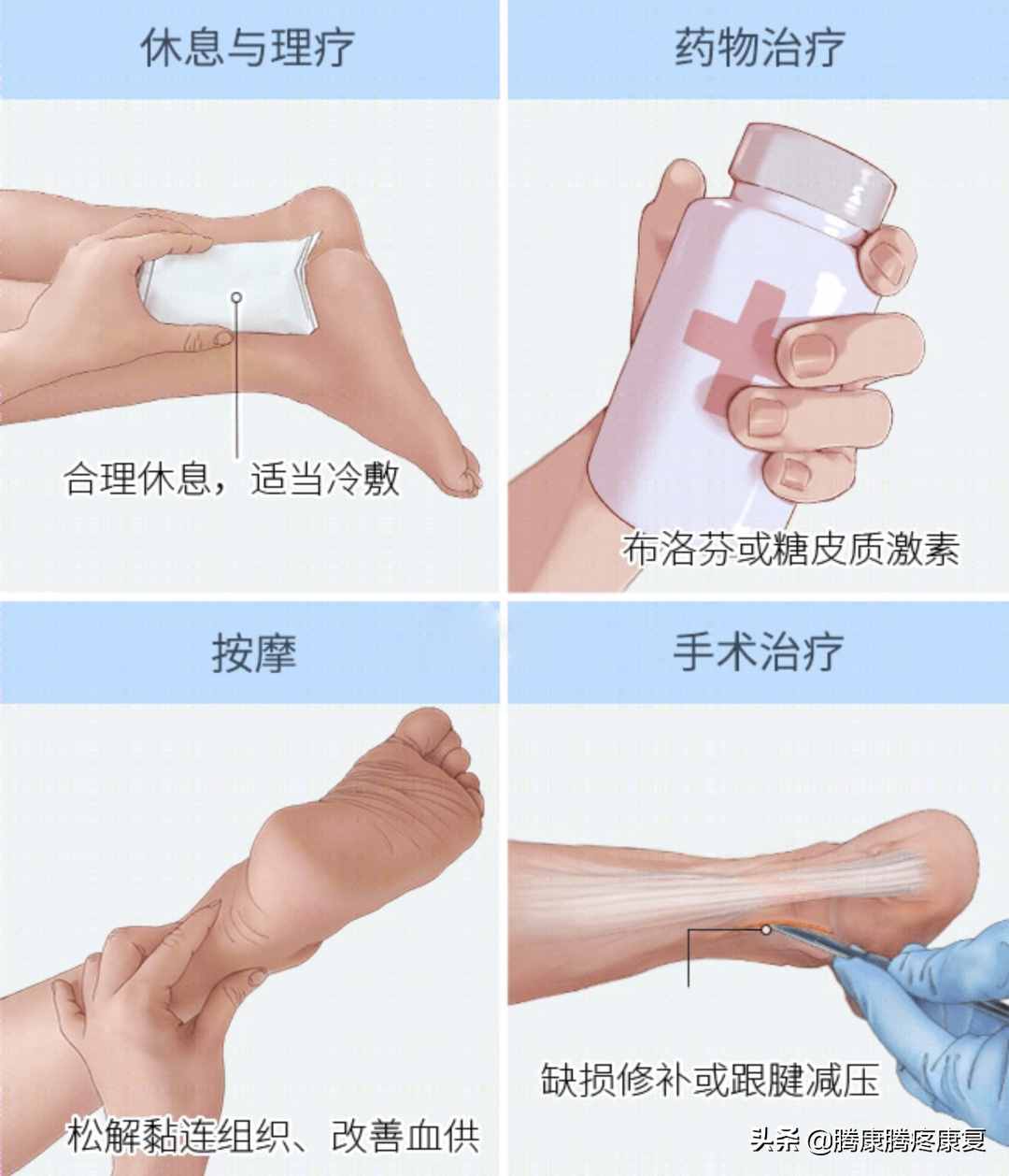 跟腱炎的分析與診療