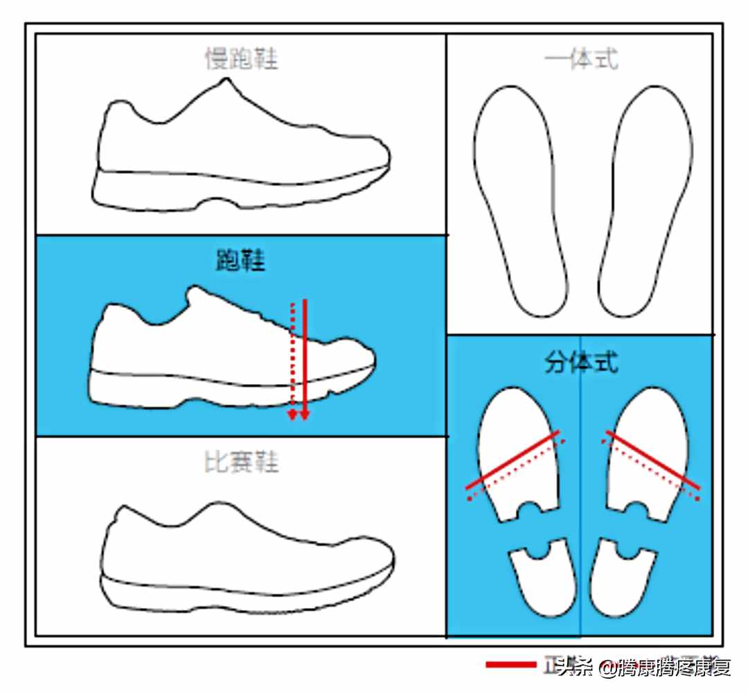 跟腱炎的分析與診療