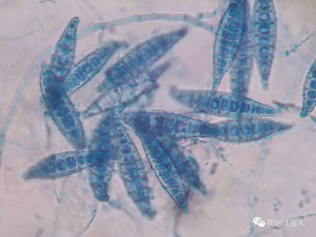 狗狗得了真菌性皮膚病該怎么辦？