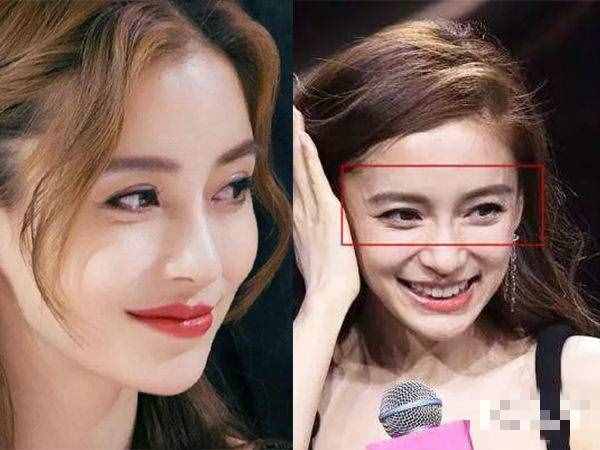 迪麗熱巴都消不掉的眼紋，你想靠眼霜和按摩就消掉？