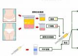 今日更新吸脂好不好（芒果吸脂手術(shù)的安全性怎么樣）