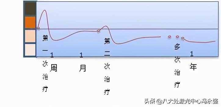 光子嫩膚——祛斑的心路歷程