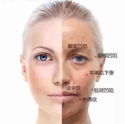 面部凹陷，皮膚松弛，像顆缺水的葡萄干，怎么辦？
