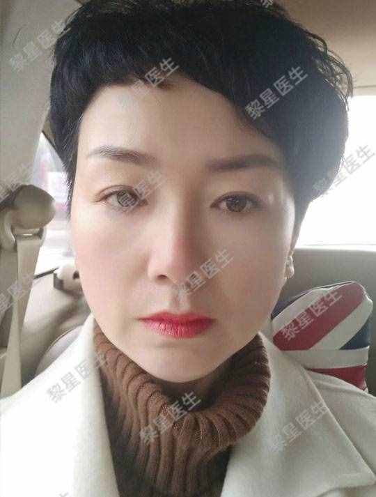面部凹陷，皮膚松弛，像顆缺水的葡萄干，怎么辦？
