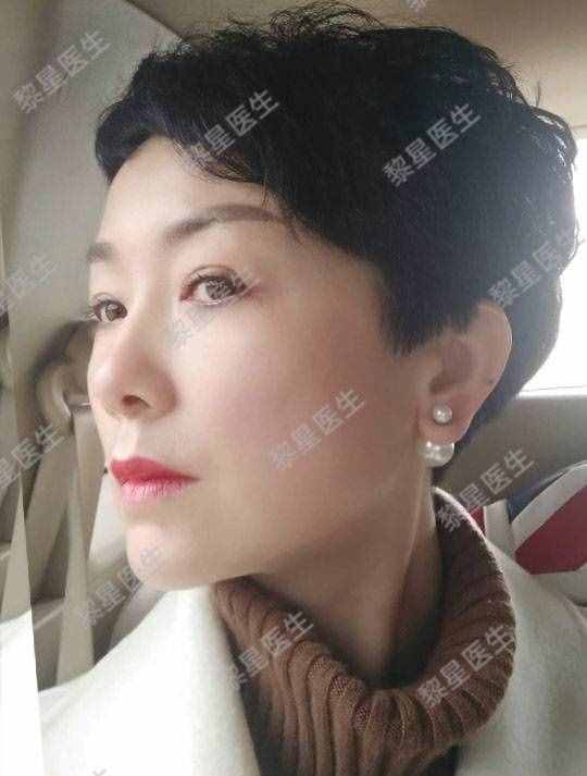 面部凹陷，皮膚松弛，像顆缺水的葡萄干，怎么辦？