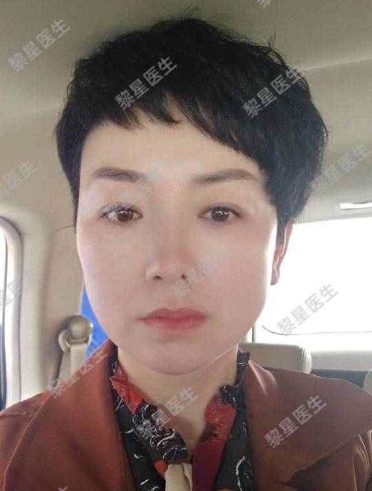 面部凹陷，皮膚松弛，像顆缺水的葡萄干，怎么辦？