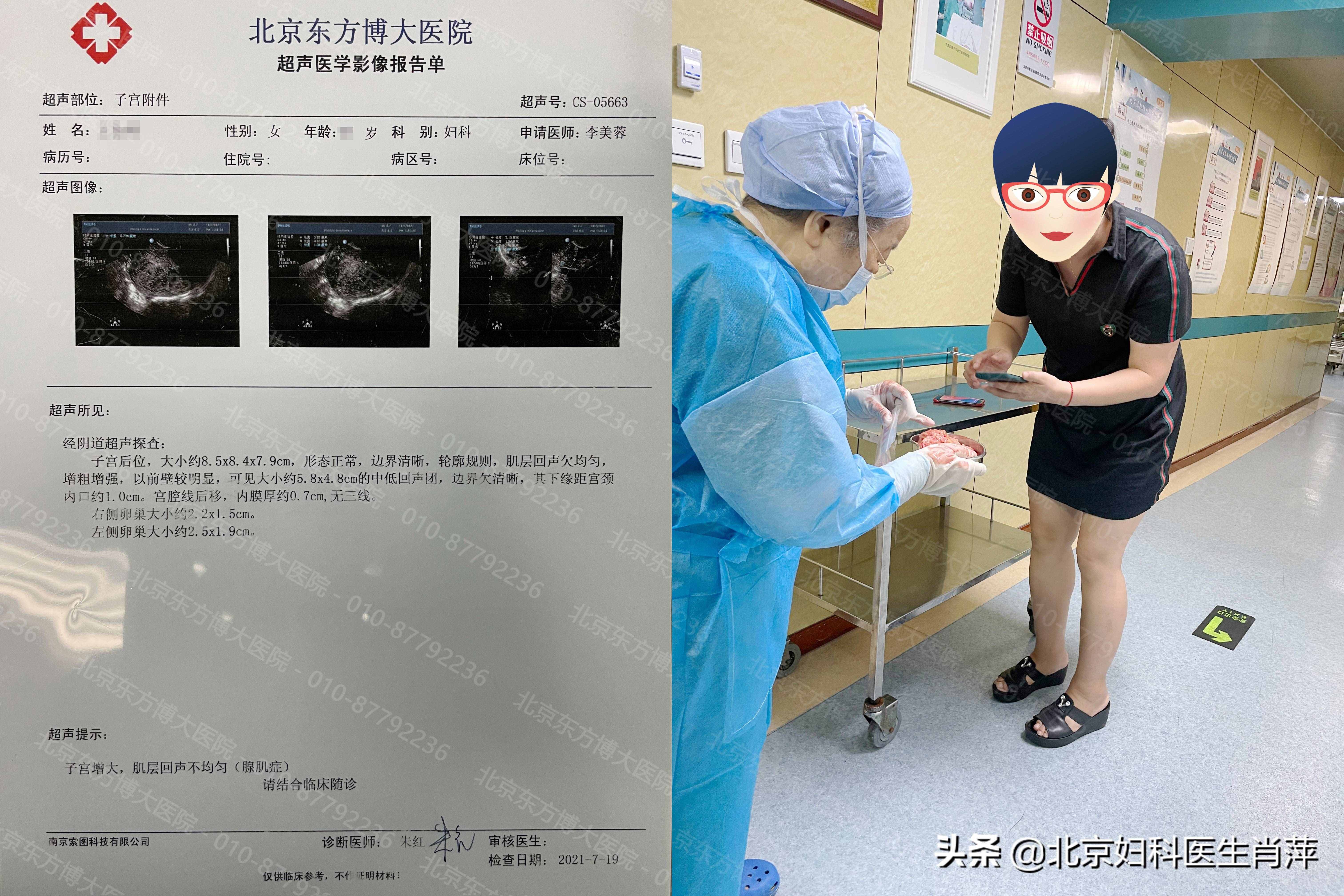 腺肌癥有什么辦法可以治愈？孫愛達(dá)治子宮腺肌癥