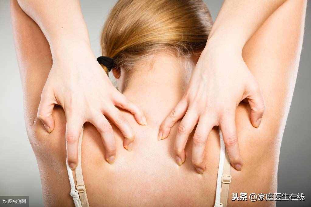 如何應(yīng)對螨蟲性皮炎？皮膚科醫(yī)生給出了建議！不防聽一聽
