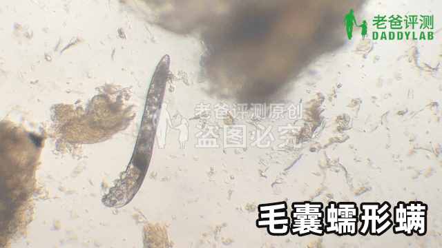 竟然在人臉上找到了螨蟲(chóng)，還在動(dòng)