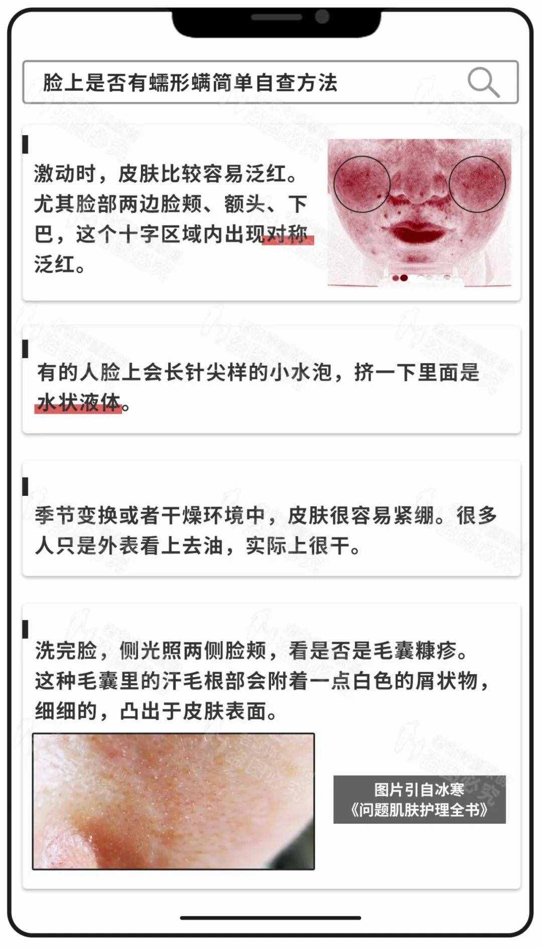 竟然在人臉上找到了螨蟲(chóng)，還在動(dòng)