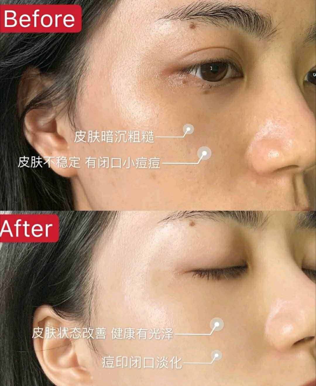 原來精華液不是直接涂？難怪涂了沒效果！快來看看正確的使用方法