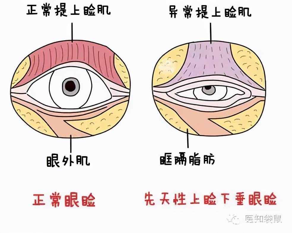為什么從小就有抬頭紋，眼睛還比別人?。? class=