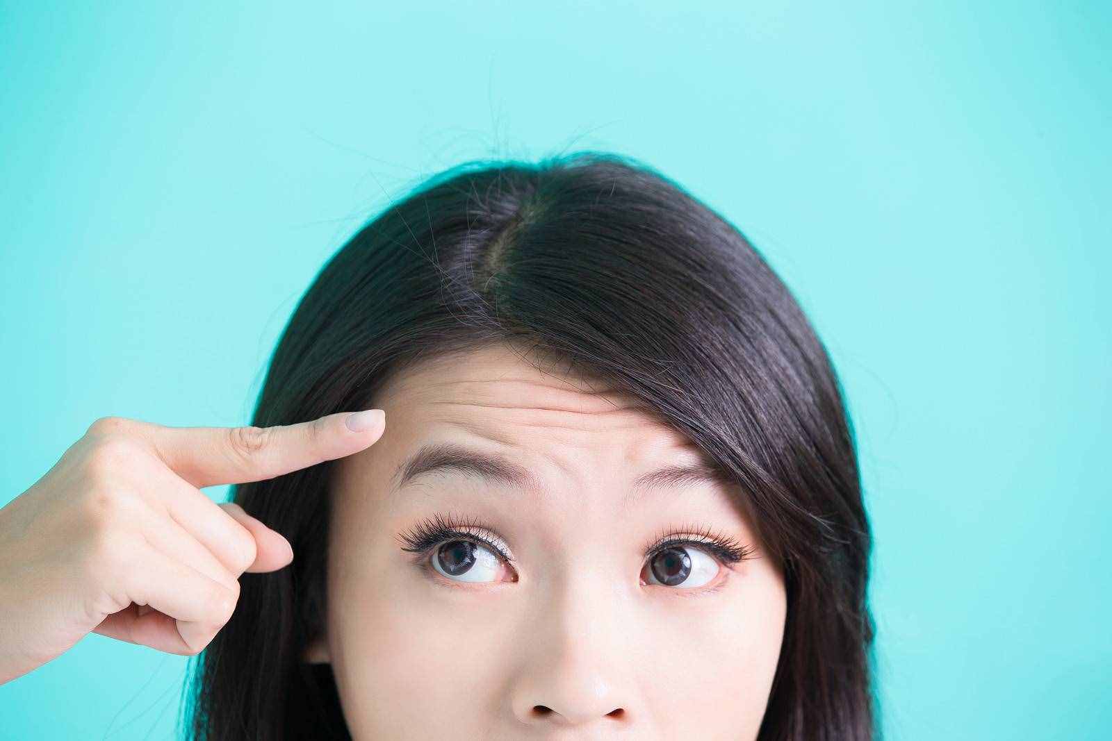 為什么從小就有抬頭紋，眼睛還比別人??？