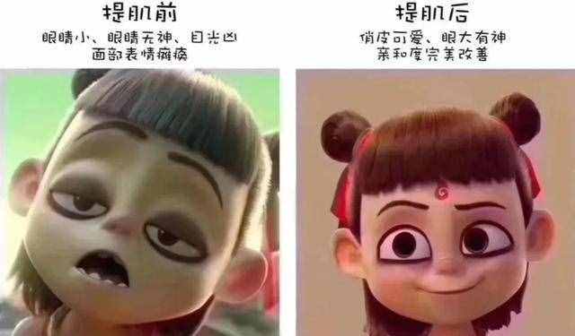 為什么從小就有抬頭紋，眼睛還比別人??？