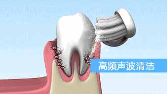 電動(dòng)牙刷的價(jià)格屠夫，29元三個(gè)刷頭，功能不輸幾百元的大牌牙刷