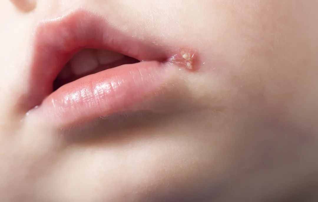 身上突然長(zhǎng)了很多小紅點(diǎn)，這是怎么了？