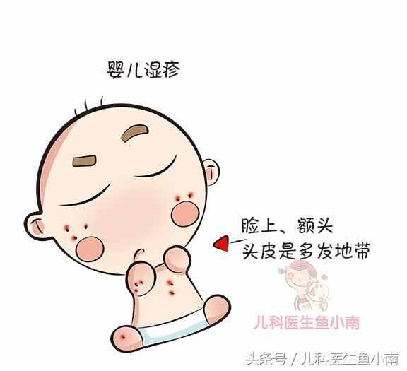 雖然只有一字之差，但寶寶濕疹熱疹大不同，醫(yī)生教辨別和護(hù)理方法