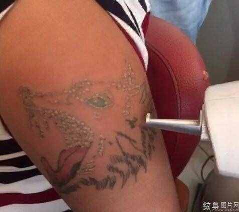 怎樣去掉紋身，四種常見(jiàn)洗紋身方法