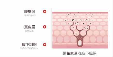 對(duì)激光美白心動(dòng)但又不敢做？親身經(jīng)驗(yàn)告訴你效果如何