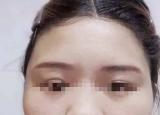 今日更新改臉型多少錢(換一張臉需要多少錢)