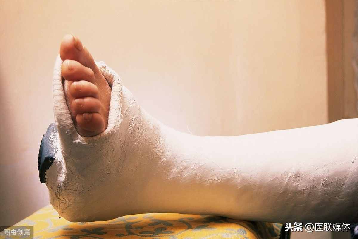 骨折后吃什么好得快？告訴你3種補(bǔ)鈣的食物，別只盯著骨頭湯
