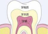 今日更新補(bǔ)牙洞多少錢(補(bǔ)牙洞的過程是怎樣的)