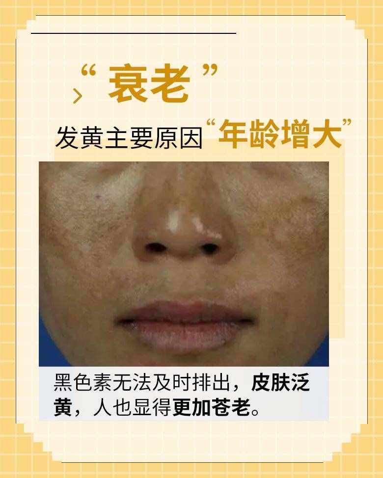 皮膚越來越黃，是怎么回事？