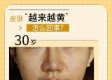 今日更新皮膚很黃!（皮膚發(fā)黃是病嗎）