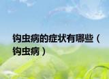 鉤蟲病的癥狀有哪些（鉤蟲?。? /></span></a>
                        <h2><a href=