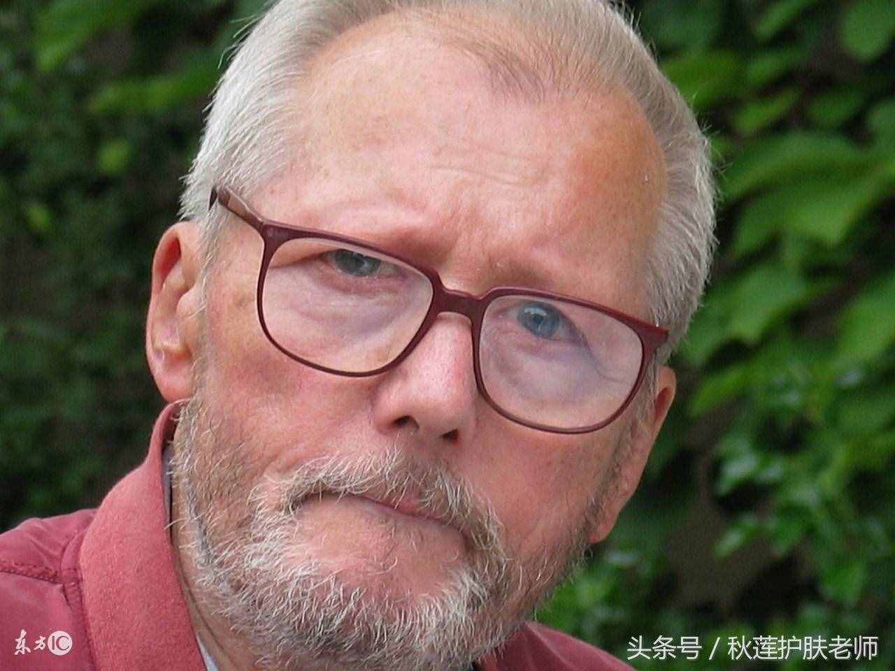原來(lái)紅血絲是不會(huì)遺傳的！那先天紅血絲怎么來(lái)的？可以治好嗎？