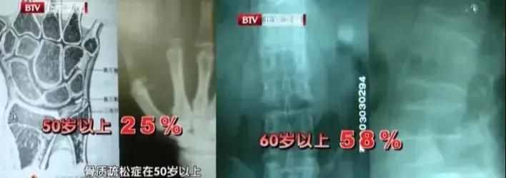 補(bǔ)鈣第一名不是牛奶！這份補(bǔ)鈣排行榜快收好，照著吃準(zhǔn)沒錯(cuò)