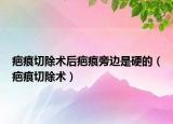 疤痕切除術(shù)后疤痕旁邊是硬的（疤痕切除術(shù)）