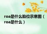 roa是什么胎位示意圖（roa是什么）