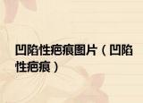 凹陷性疤痕圖片（凹陷性疤痕）