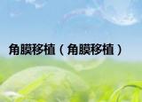 角膜移植（角膜移植）