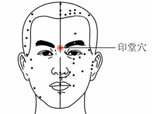 印堂是哪里 印堂發(fā)黑有什么寓意