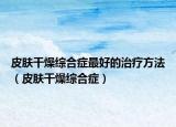 皮膚干燥綜合癥最好的治療方法（皮膚干燥綜合癥）