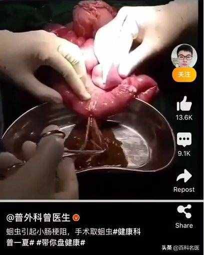 不用愁，肚子里有蛔蟲，從兩個方面就能驅(qū)逐它