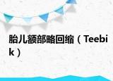 胎兒額部略回縮（Teebik）