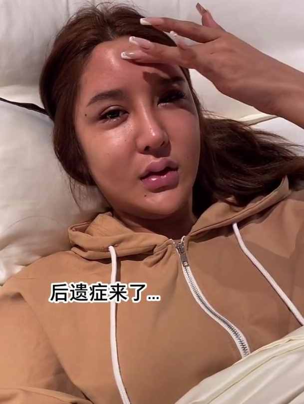 23歲網(wǎng)紅整容出現(xiàn)后遺癥，臉部浮腫額頭凹陷，曾在6年內(nèi)花費(fèi)百萬(wàn)