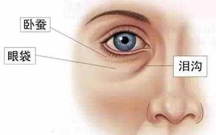不再為淚溝發(fā)愁，這些方法可以徹底消除它們