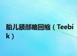 胎兒額部略回縮（Teebik）