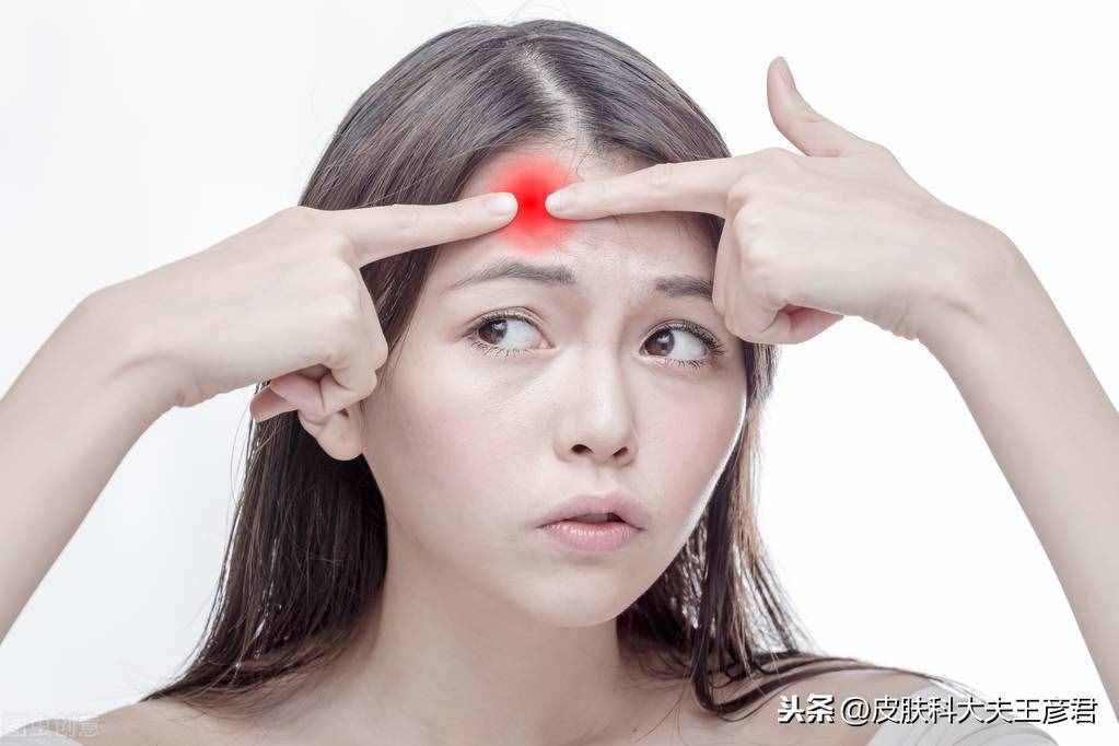 臉上痘痘變硬的原因及其解決方案