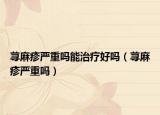 蕁麻疹嚴(yán)重嗎能治療好嗎（蕁麻疹嚴(yán)重嗎）