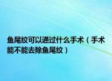 魚(yú)尾紋可以通過(guò)什么手術(shù)（手術(shù)能不能去除魚(yú)尾紋）