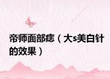 帝師面部痣（大s美白針的效果）