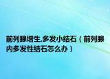前列腺增生,多發(fā)小結石（前列腺內多發(fā)性結石怎么辦）