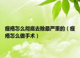 痤瘡怎么徹底去除最嚴重的（痤瘡怎么做手術）